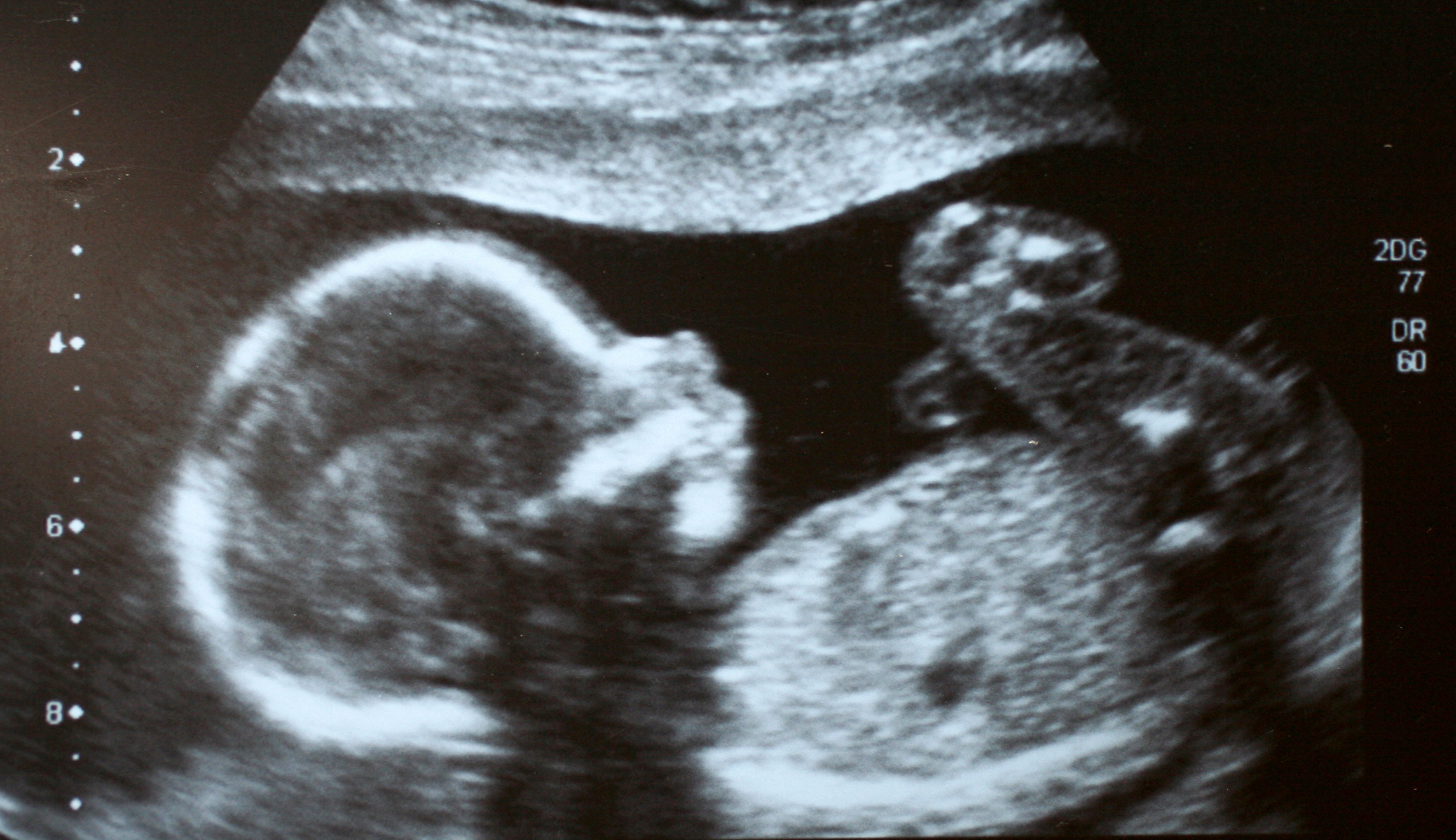 Fact Check: CNN brings in pro-abortion doctors to educate ‘anti-choice’ advocates on late-term abortions