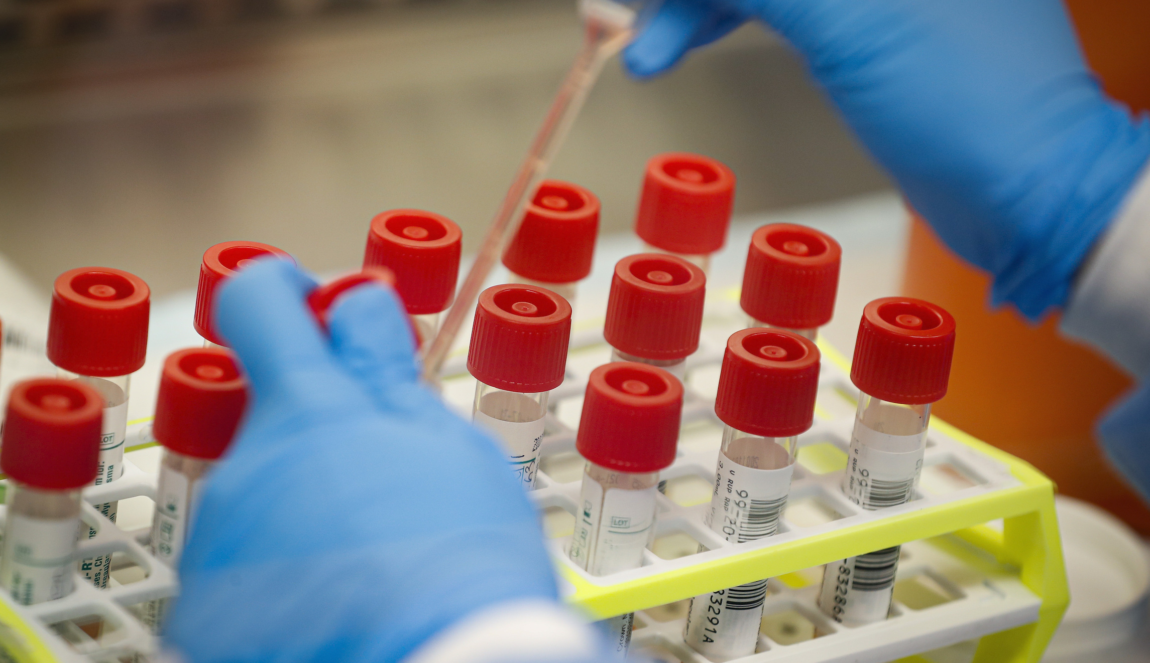 FDA is standing in the way of Bill Gates’s coronavirus testing
